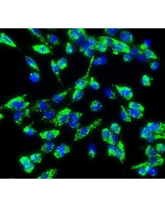 Human Aortic Endothelial Cells (HAEC) - Immunostaining for vWF, 200x.