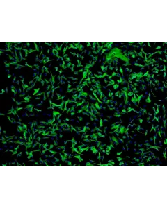 Human Astrocytes-cerebellar (HA-c) - Immunostaining for GFAP, 100x.
