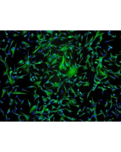 Human Astrocytes-midbrain (HA-mb) - Immunostaining for GFAP, 100x.
