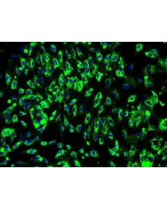 Human Bladder Microvascular Endothelial Cells (HBdMEC) - Immunostaining for vWF, 200x.
