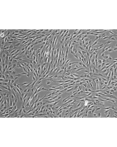 HumanBone Marrow-derived_Mesenchymal_Stem_Cells (HMSC-bm) – Phase contrast, 100x.
