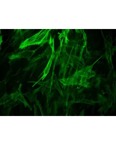Human Brain Vascular Smooth Muscle Cells [HBVSMC] - Immunostaining for α-SMA, 400x.