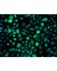 Human Bronchial Epithelial Cells-adult (HBEpiC-a) - Immunostaining for CK-18 200x