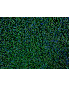 Human Bronchial Fibroblasts (HBF) - Immunostaining for Fibronectin, 100x.
