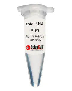 Human Cardiac Fibroblast-adult atrial Total RNA