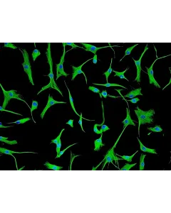 Human Cardiac Fibroblasts-adult (HCF-a) - Immunostaining for Vimentin, 200x.
