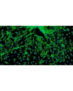 Human Cardiac Fibroblasts-fetal atrial (HCF-fa) - Immunostaining for Fibronectin, 100x.
