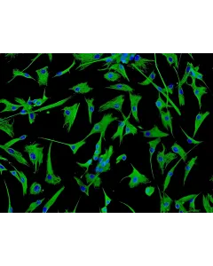 Human Cardiac Fibroblasts-atrial (HCF-aa) - Immunostaining for Vimentin, 200x.