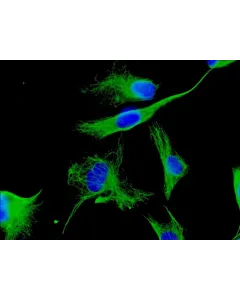 Human Cardiac Fibroblasts (HCF) - Immunostaining for Vimentin, 600x..