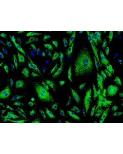 Human Cardiac Microvascular Endothelial Cells (HCMEC) - Immunostaining for vWF, 200x.
