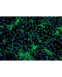 Human Cardiac Myocytes-adult (HCM-a) - Immunostaining for Sarcomeric α-Actinin, 100x.