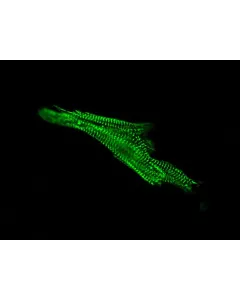 Human Cardiac Myocytes (HCM) – Immunostaining for Sarcomeric alpha-Actinin (Boster, Cat #MA1104)
 
