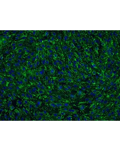 Human Cervical Microvascular Endothelial Cells (HCerMEC)-Immunostaining for vWF, 200x
