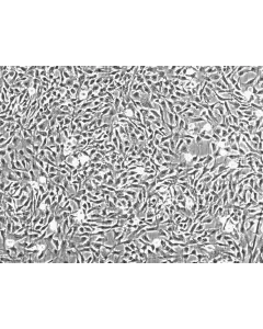 Human Chondrocytes-articular (HC-a) - Phase contrast, 100x.
