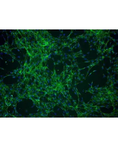 Human Choroid Plexus Fibroblasts (HCPF) - Immunostaining for Fibronectin, 100x.
