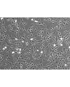 Human Colonic Fibroblasts (HCoF)- Phase Contrast, 100x
