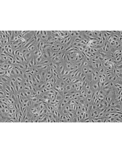 Human Colonic Microvascular Endothelial Cells (HCoMEC) - Phase contrast, 100x.
