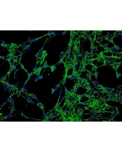 Human Conjunctival Fibroblasts (HConF) - Immunostaining for Fibronectin, 200x.
