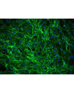 Human Dermal Fibroblasts-fetal (HDF-f) - Immunostaining for Fibronectin, 200x.
