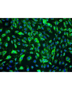 Human Dermal Lymphatic Endothelial Cells (HDLEC) - Immunostaining for vWF, 200x.
