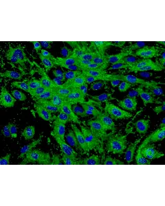 Human Dermal Microvascular Endothelial Cells (HDMEC) - Immunostaining for vWF, 400x.
