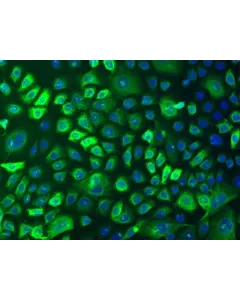 Human Epidermal Keratinocytes-adult (HEK-a) - Immunostaining for CK-18, 100x.
