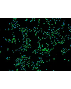 Human Epidermal Keratinocytes-fetal (HEK-f) - Immunostaining for CK-18, 100x.
