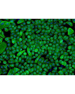 Human Epidermal Keratinocytes-neonatal (HEK-n) - Immunostaining for CK-18, 200x.
