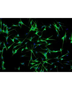 Human Epidermal Melanocyte-adult (HEM-a) - Immunostaining for S100-β, 100x.
