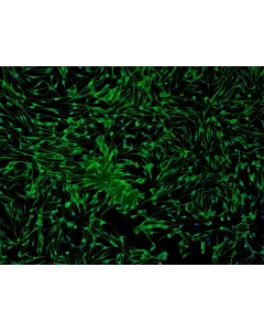 Human Epidermal Melanocytes-light (HEM-l) - Immunostaining for S100-β, 100x.
