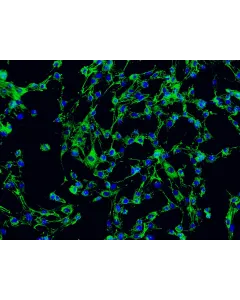 2730 Immunostaining FN 200x
