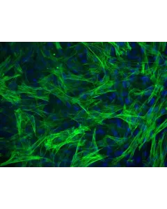 Human Esophageal Smooth Muscle Cells (HESMC) - Immunostaining for α-SMA, 200x.
