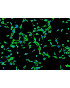 Human Gallbladder Fibroblasts (HGBF) - Immunostaining for Fibronectin, 200x.

