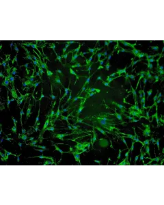 Human Hair Dermal Papilla Cells (HHDPC) - Immunostaining for Fibronectin, 100x.
