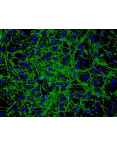 Human Hair Germinal Matrix Cells (HHGMC) - Immunostaining for Fibronectin, 200x.
