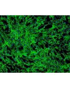 Human Hair Inner Root Sheath Cells (HHIRSC) - Immunostaining for Fibronectin, 100x.
