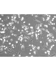 Human Hepatic Macrophages (HHMa) – Phase Contrast, 100x
