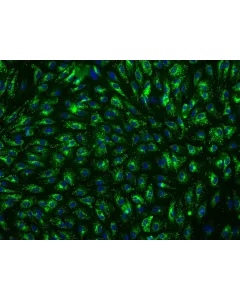 Human Hepatic Sinusoidal Endothelial Cells (HHSEC) - Immunostaining for vWF, 200x
