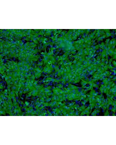 Human Hepatocytes (HH) - Immunostaining for CK-18, 100x.
