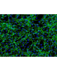 Human Intestinal Fibroblasts (HIF) - Immunostaining for Fibronectin, 200x.
