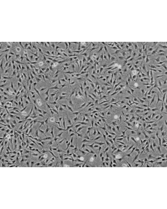 Human Keratocytes (HK) - Phase contrast, 100x.

