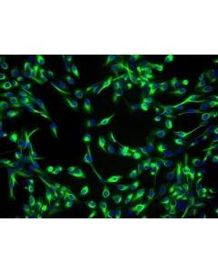 Human Lens Epithelial Cells (HLEpiC) - Immunostaining for CK-19, 200x.

