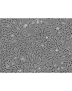 Human Liver-derived Mesenchymal Stem Cells (HMSC-he) - Phase contrast, 100x.
