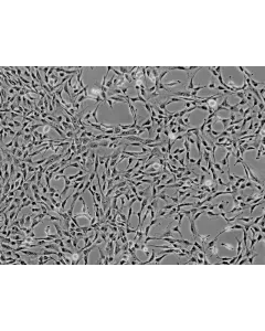Human Liver-derived Mesenchymal Stem Cells (HMSC-he) - Phase contrast, 100x.
