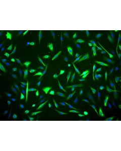 Human Mammary Epithelial Cells (HMEpiC) - Immunostaining for CK-18, 200x.

