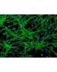 Human Meningeal Cells (HMC) - Immunostaining for Fibronectin, 200x.
