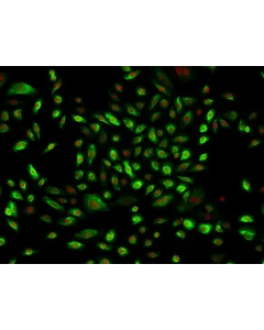 Human Middle Ear Epithelial Cells (HMEEpiC)-Immunostaining for CK-18, 200x