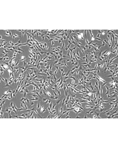 Human Middle Ear Fibroblasts (HMEF)-Phase Contrast, 100x