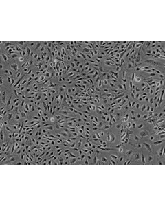 Human Myometrial Microvascular Endothelial Cells (HMMEC)-Phase Contrast, 200x.
