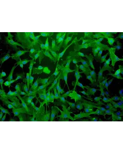 Human Myometrial Smooth Muscle Cells (HMSMC)-Immunostaining for α-sma, 200x.
